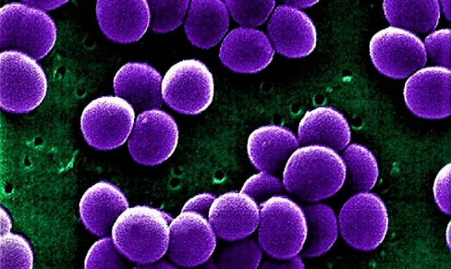 Staphylococcus aureus. Foto - thenationonlineng.net