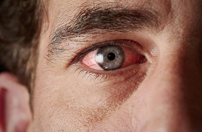 Foto – Shutterstock